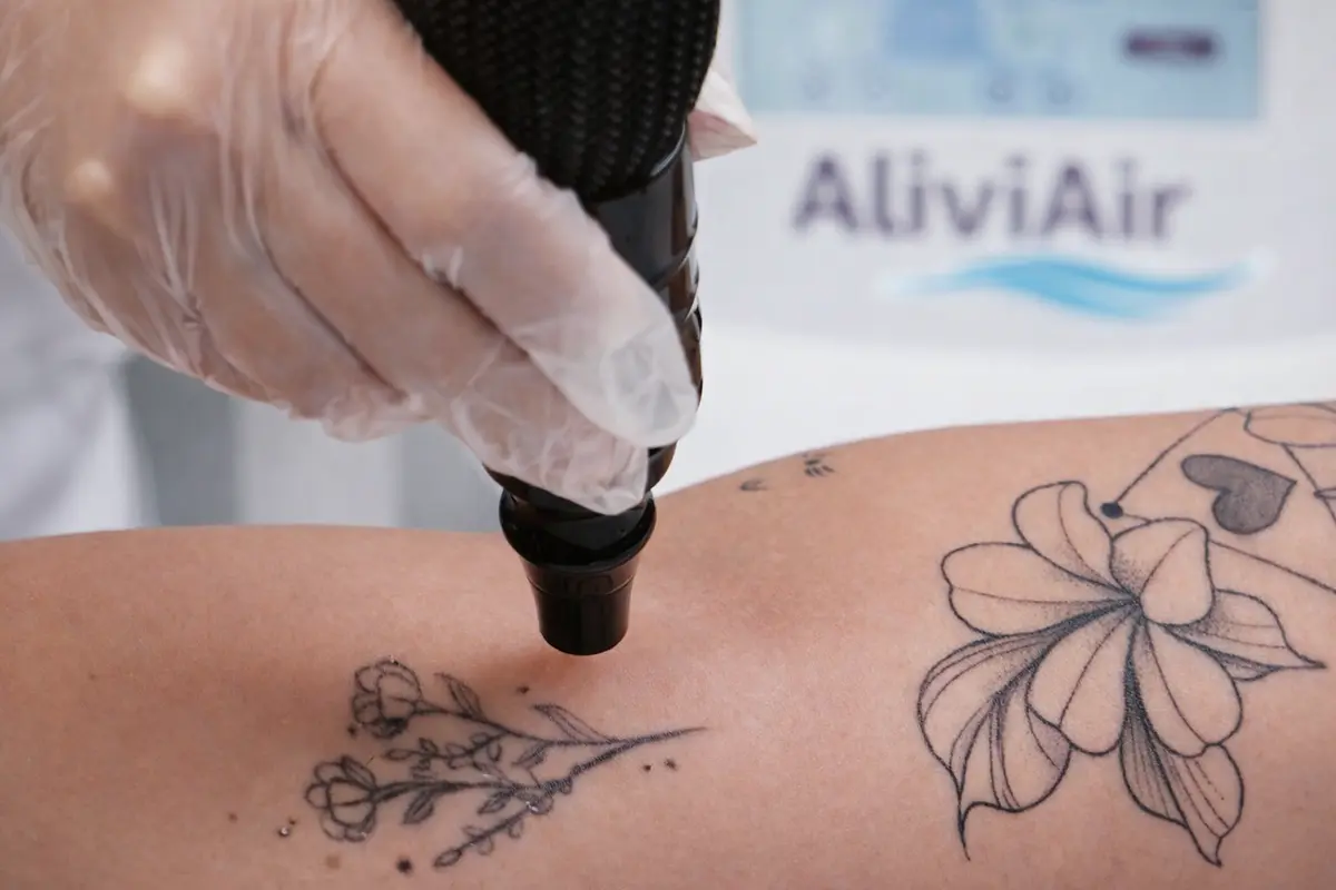 AliviAir HTM - aplicação estética